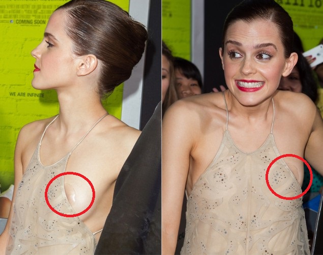 Emma Watson Celebrity Wardrobe Malfunctions Emma Watson Celebrity Wardrobe Malfunctions