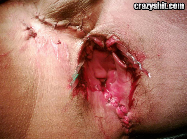 Porn Girl Gets Her Ass Hole Ripped