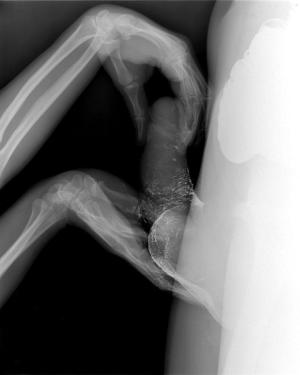 X Ray People Having Sex X Ray People Having Sex