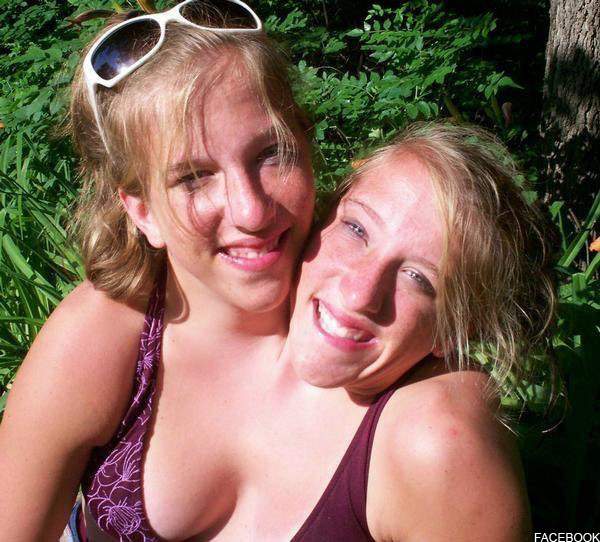 Conjoined Twins Abby And Brittany Hensel Conjoined Twins Abby And Brittany Hensel