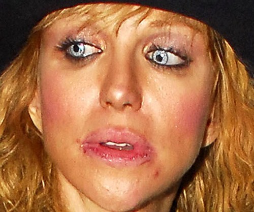 Courtney Love Lip Injections