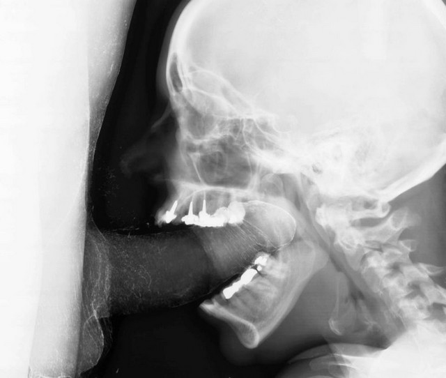 X Ray Cock X Ray Cock